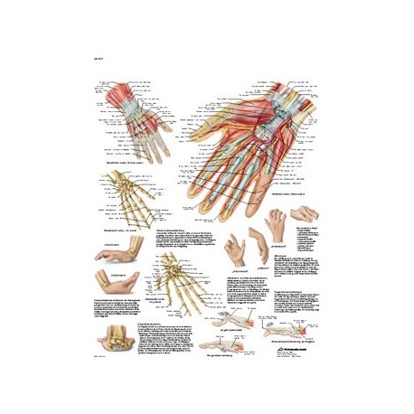Lámina "Mano y articulación radiocarpiana - Anatomía y patología