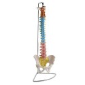 Columna vertebral Didáctica con hernia de disco