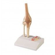 Mini modelo de articulación de rodilla con sección transversal