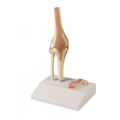 Mini modelo de articulación de rodilla con sección transversal