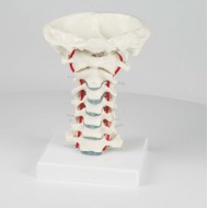 Columna cervical con trípode