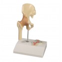 Mini modelo de articulación de cadera con sección transversal